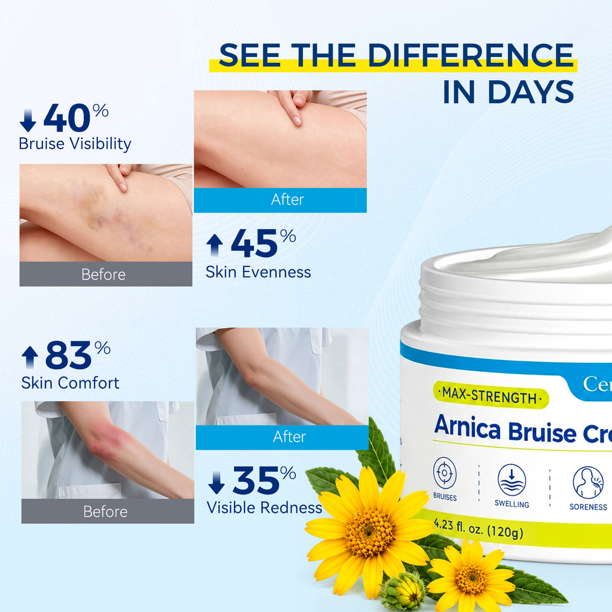 Cerylo Arnica Botanical Cream