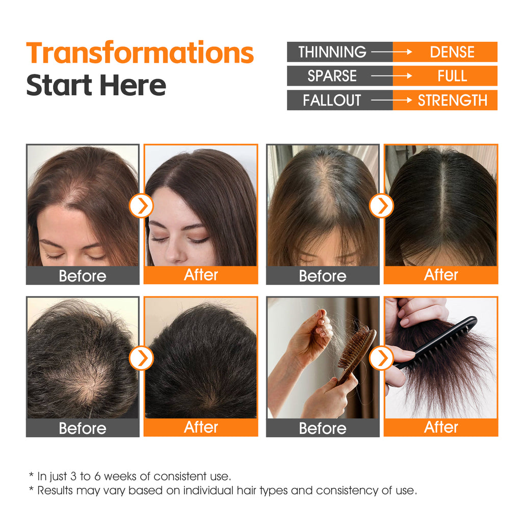ABARNO Biotin + Rosemary Hair & Scalp Spray