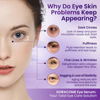 Doracome Retinol + Collagen Eye Serum