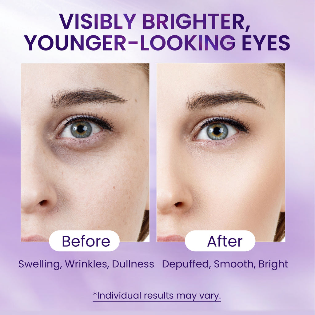 Doracome Retinol + Collagen Eye Serum