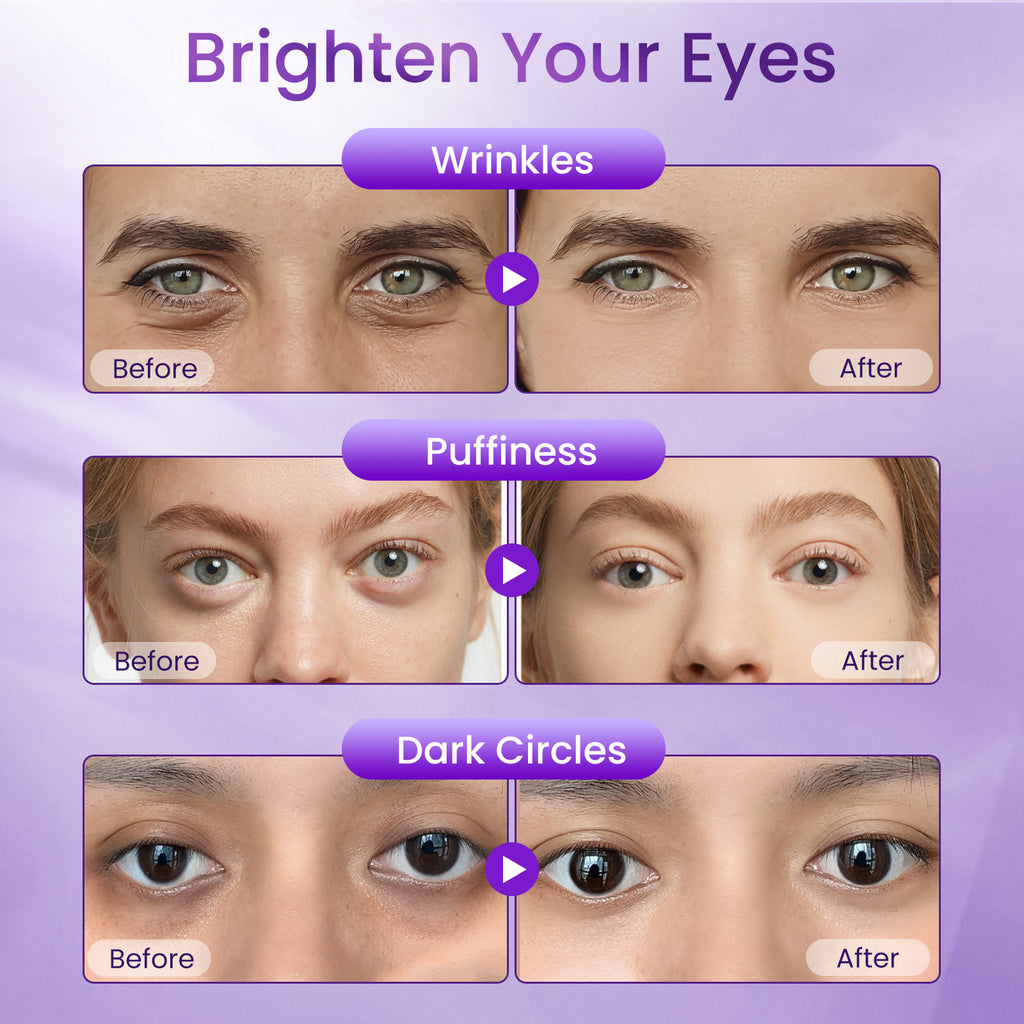 Doracome Retinol + Caffeine Eye Cream