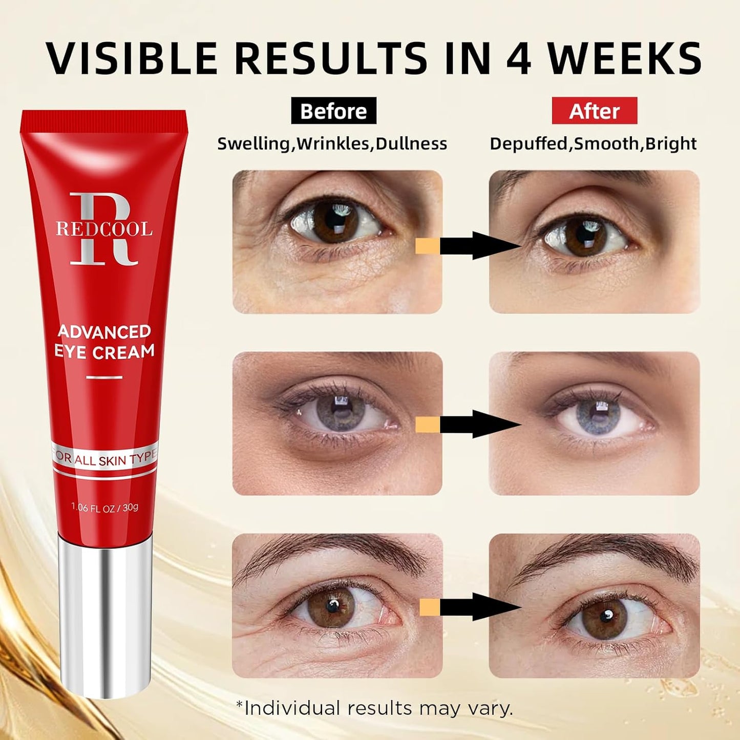 Retinol Eye Cream for Dark Circles, Anti-Aging Eye Cream with Hyaluronic Acid & Caffeine, Reduces Wrinkles, Puffiness & Fine Lines, Day and Night Use, 1.06 fl oz